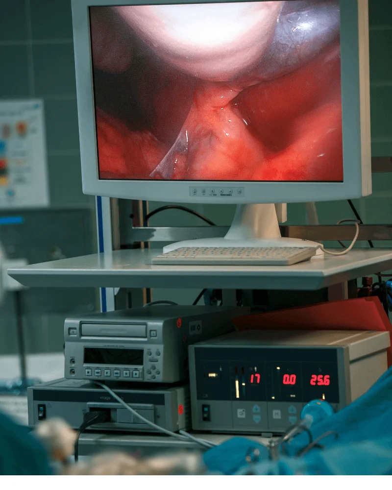 cirujano-de-hernias-en-Zapopan