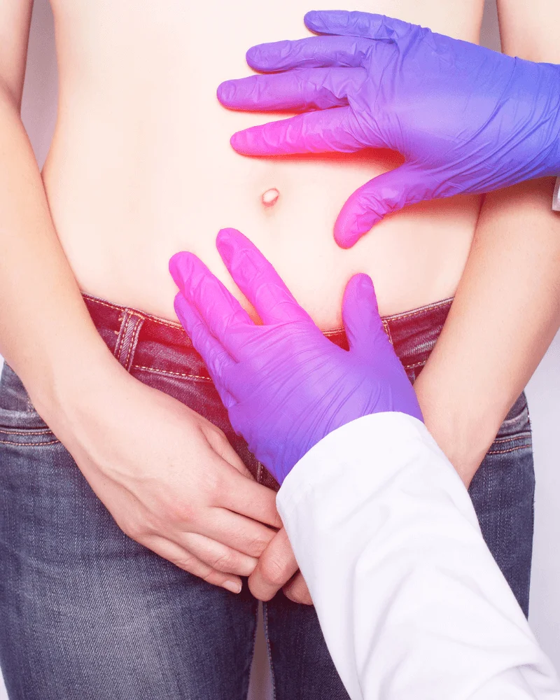 cirujano-de-hernias-en-Zapopan