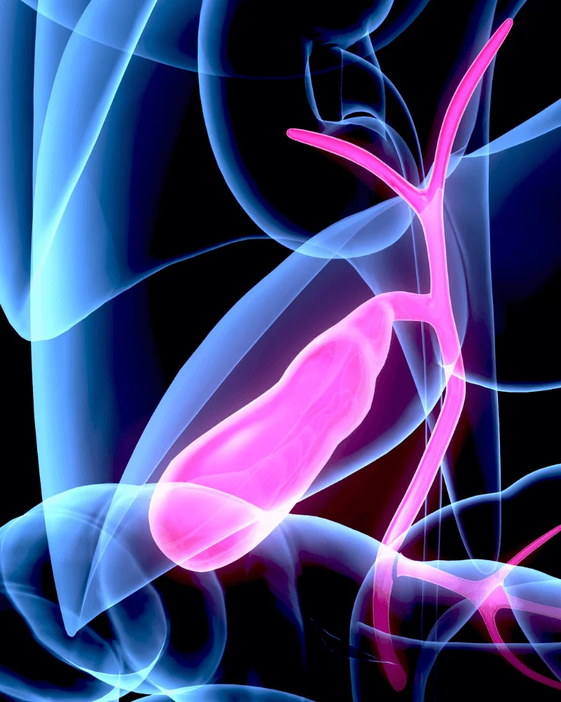 cirujano-de-hernias-en-Zapopan