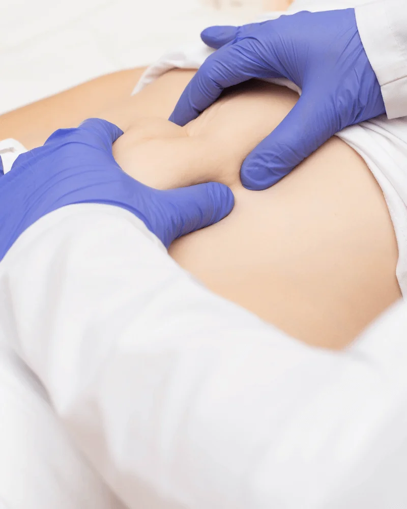 cirujano-de-hernias-en-Zapopan