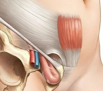 Hernioplastias de Pared abdominal