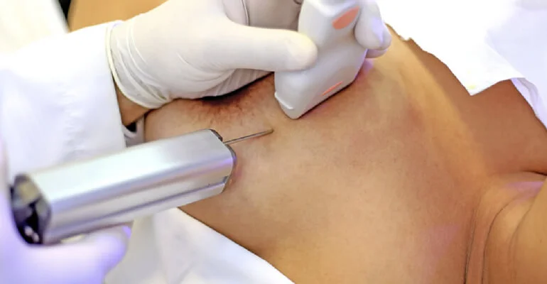 Biopsias o Resección de Mama